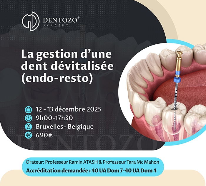 La gestion d’une dent dévitalisée (endo-resto)