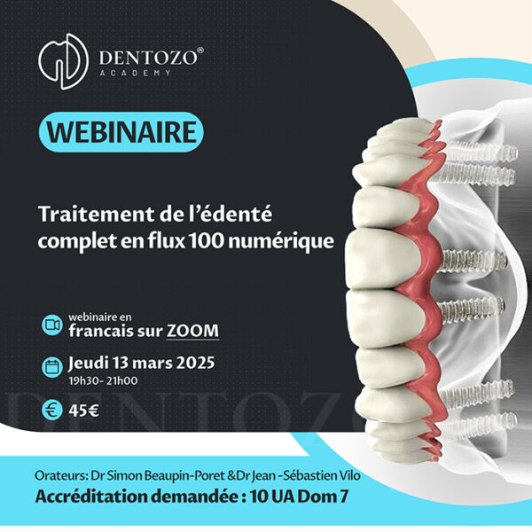 Traitement de l’Édenté Total en Flux 100% Numérique par Implant