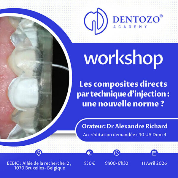 Les composites directs par technique d’injection : une nouvelle norme ?
