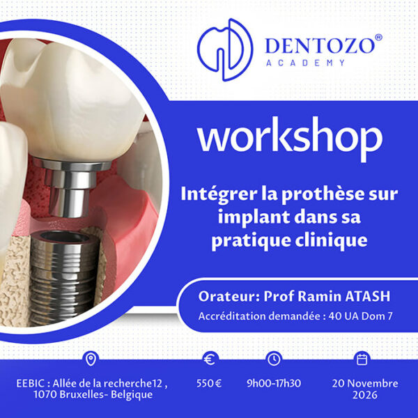 Intégrer la prothèse sur implant dans sa pratique clinique