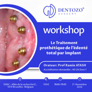 Le traitement prothétique de l’édenté total par implant