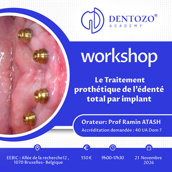 Le traitement prothétique de l’édenté total par implant