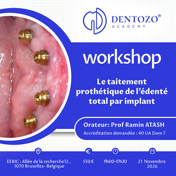 Le traitement prothétique de l’édenté total par implant