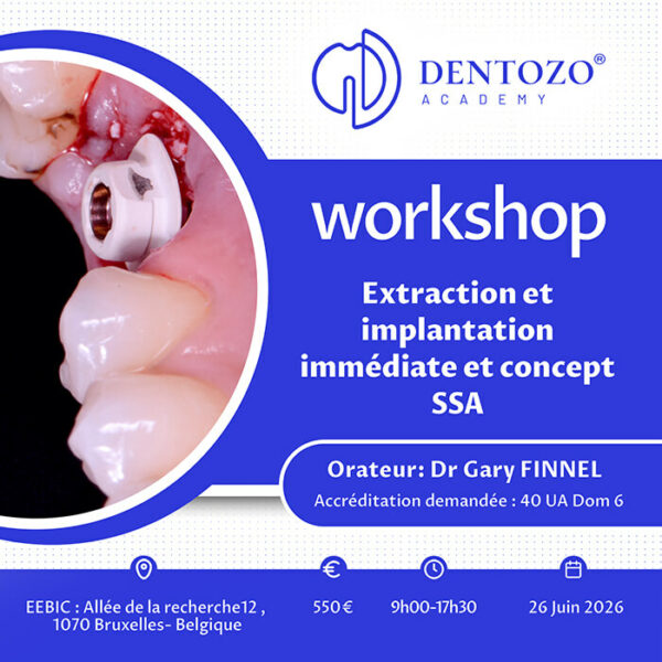 Extraction et implantation immédiate et concept SSA