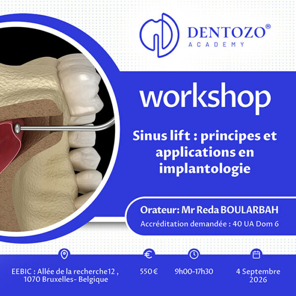 Sinus lift : principes et applications en implantologie