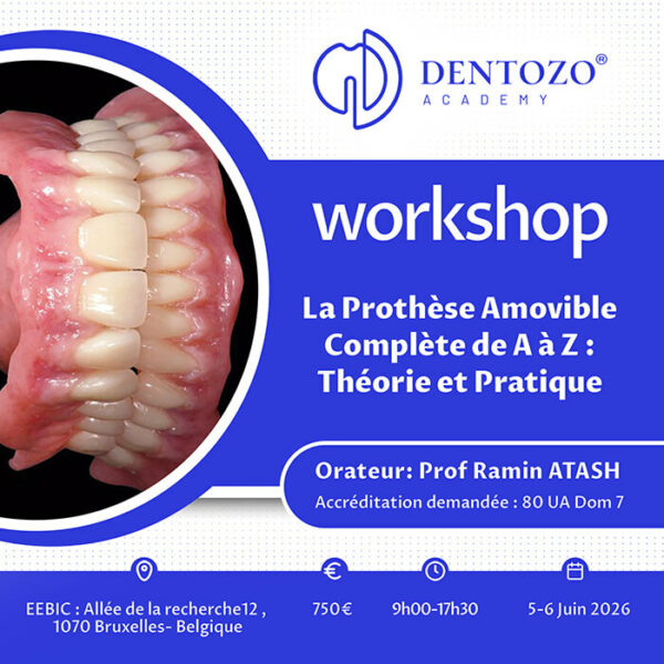 La prothèse amovible complète de A à Z : Théorie et Pratique