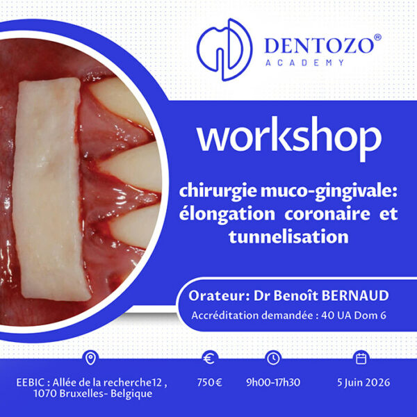 Chirurgie muco-gingivale : élongation coronaire et tunnelisation