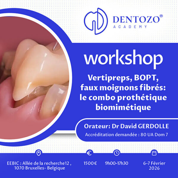 Vertipreps, BOPT, faux moignons fibrés : le combo prothétique biomimétique