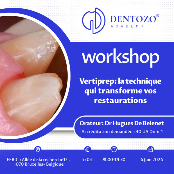 Vertiprep : la technique qui transforme vos restaurations