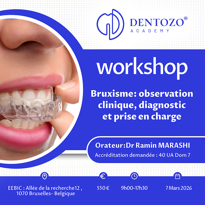 Bruxisme : observation clinique, diagnostic et prise en charge