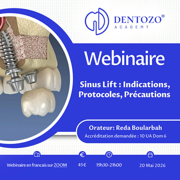 Sinus Lift : indications, protocoles, précautions