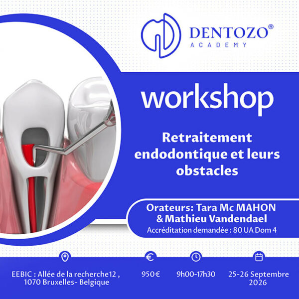 Retraitement endodontique et leurs obstacles