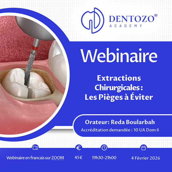 Extractions chirurgicales : les pièges à éviter