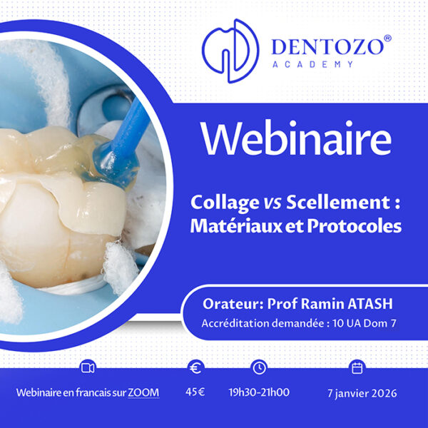 Collage vs Scellement : matériaux et protocoles