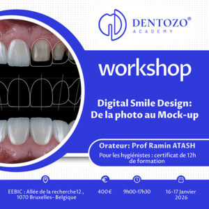 Digital Smile Design : De la photo au Mock-up
