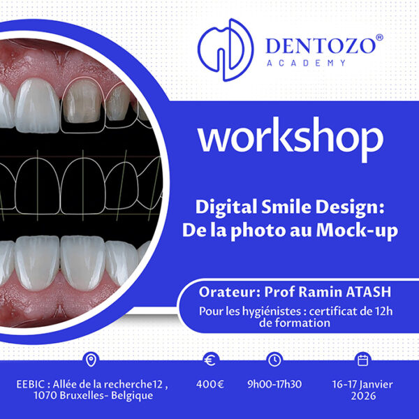 Digital Smile Design : De la photo au Mock-up