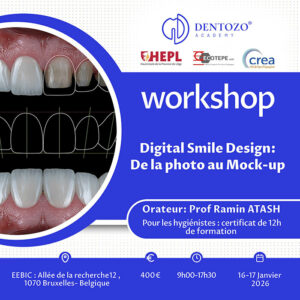 Digital Smile Design : De la photo au Mock-up