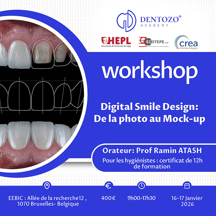 Digital Smile Design : De la photo au Mock-up